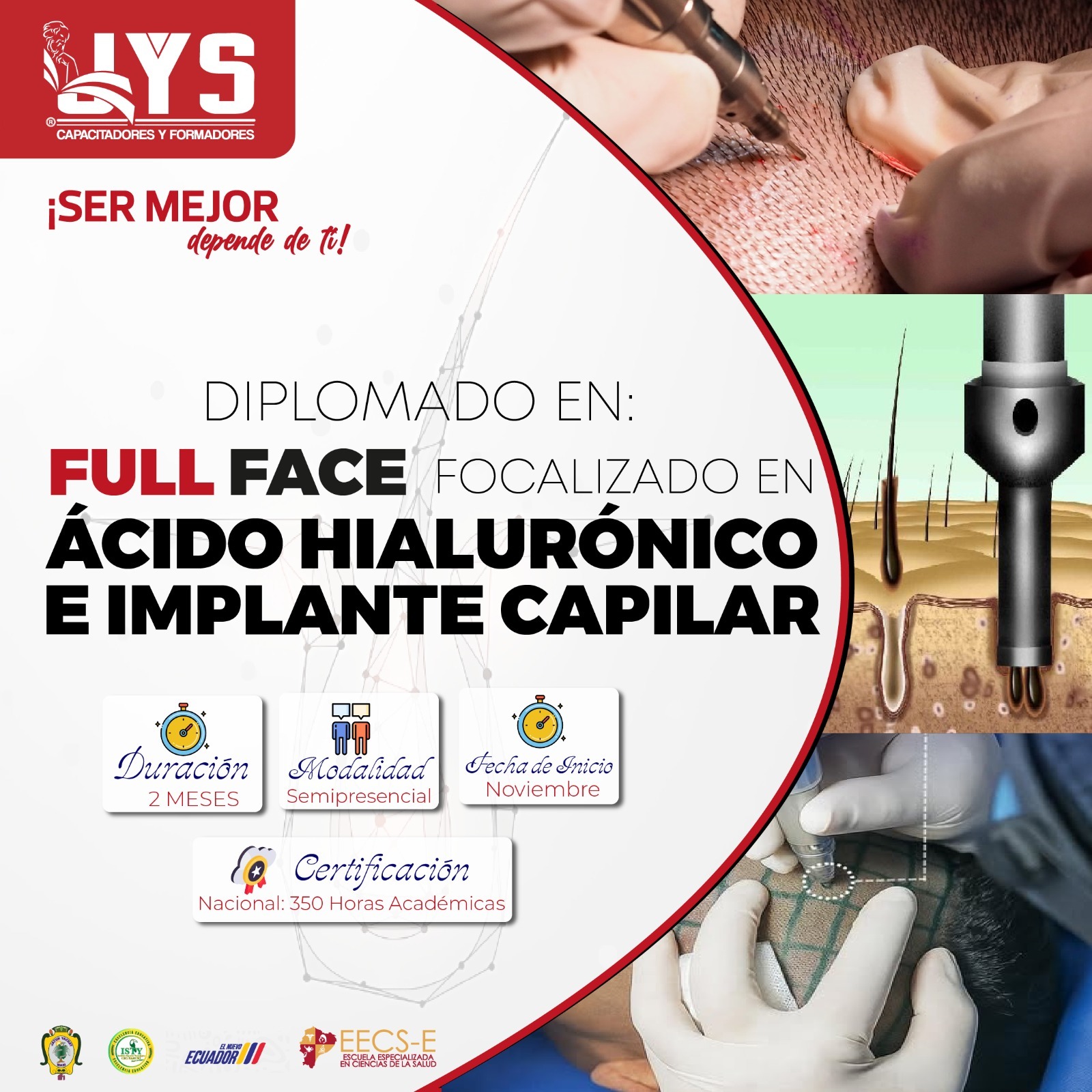Diplomado en Full Face focalizado en ácido hialurónico e implante capilar